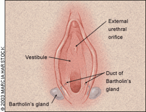 What is a Bartholin's cyst?